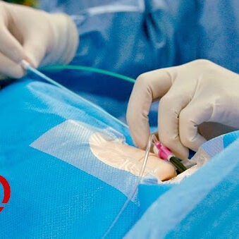 Accueil 3 dr alae chaoui cardiologue intervention edited - Dr. Chaoui Alae - Cardiologue à Tetouan