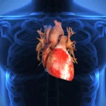 Insuffisance Cardiaque