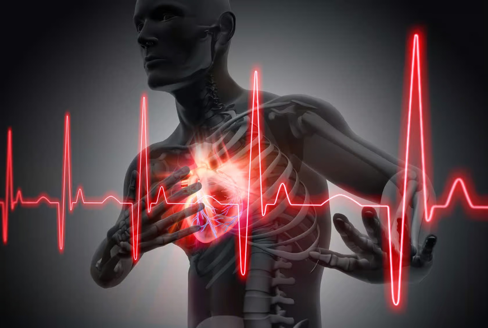 Infarctus du Myocarde : Diagnostic, Traitement et Prévention 1 Infarctus du Myocarde