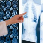 Embolie Pulmonaire Person Holding White Printer Paper