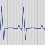 ecg, echo kardiogram, rhythm-3345115.jpg