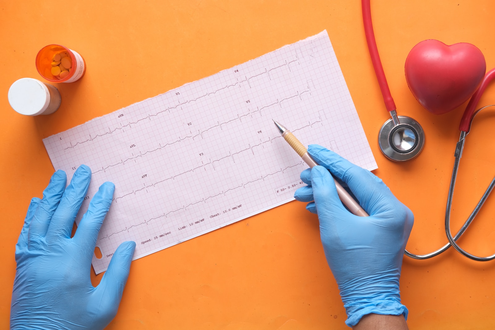La Nouvelle Ère des Soins Cardiaques: Les Avancées de la Cardiologie Interventionnelle 1 cardiologie interventionnelle