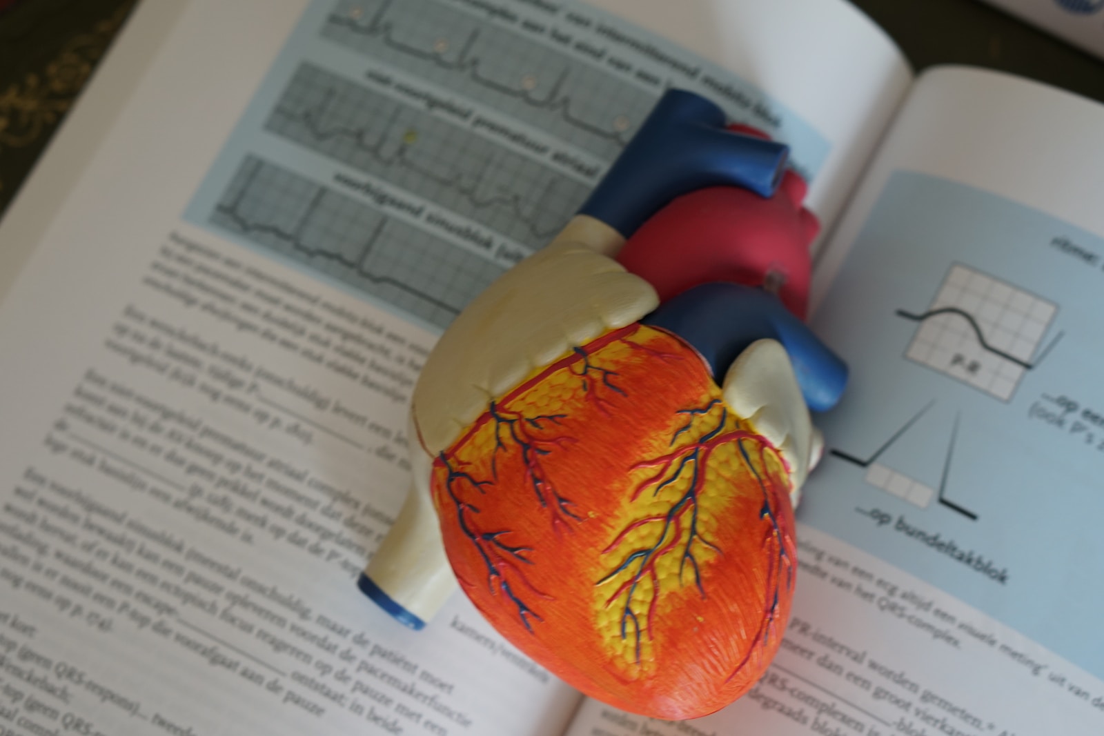 L'Arythmie Cardiaque Démystifiée: Comprendre et Agir 1 Arythmie cardiaque - human heart illustration